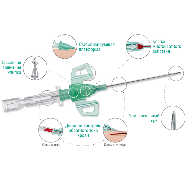 Осложнения венозного катетера. Катетер Introcan Safety 3. Катетер безопасный внутривенный «Интрокан Сэйфти 3» (Introcan Safety 3). Переферичка катетер. Катетер безопасный внутривенный Интрокан Сэйфти.